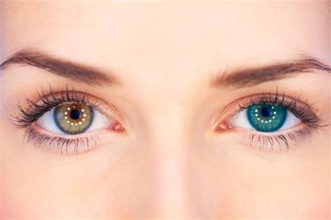 Heterocromia Quando Os Olhos Têm Cores Diferentes Tua Saúde