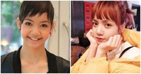 Fans Share Proof That Blackpink Lisa Never Did Plastic Surgery