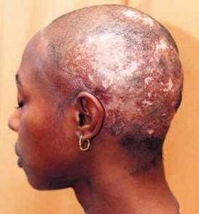 Forum home > hair care > relaxers. Why do most black men shave their heads or cut their hair ...
