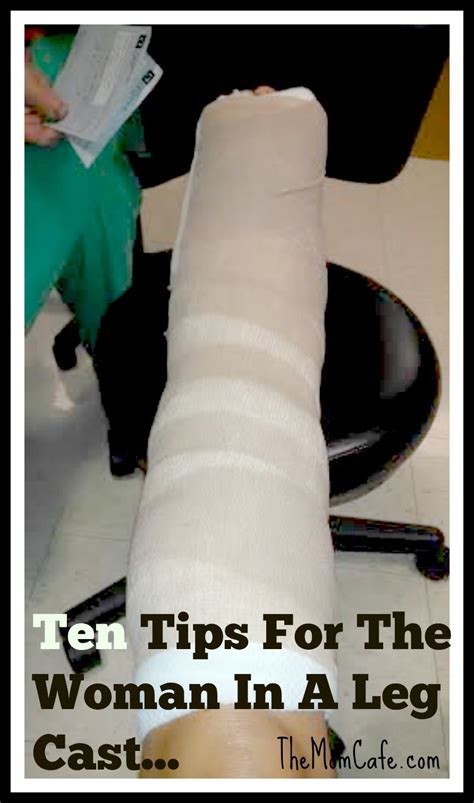 Ten Tips For The Woman In A Leg Cast