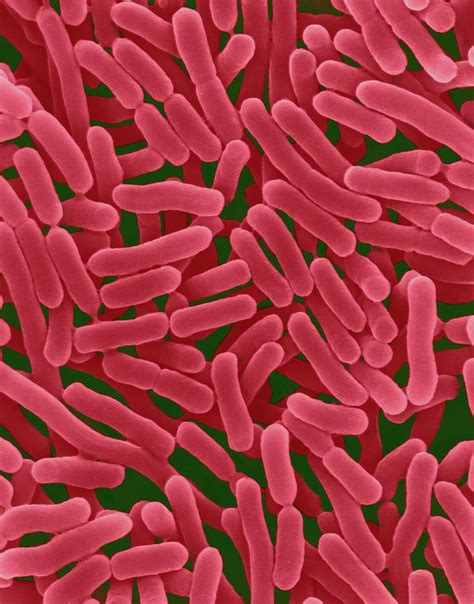 Salmonella Enterica Photograph By Dennis Kunkel Microscopy Science