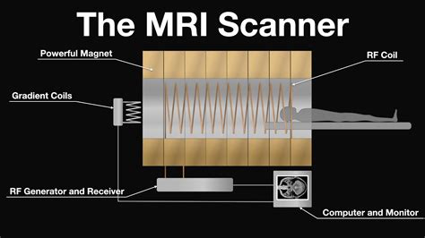 Mri Scan Animation How Magnetic Resonance Imaging Works Youtube