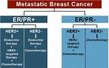 Images of Estrogen Receptor Breast Cancer Treatment