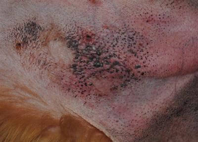 It means that the pores are clogged with dirt and dust. My dog has little black dots under his armpit and on his ...