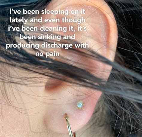 Infected Piercing Or Just Healing Piercing