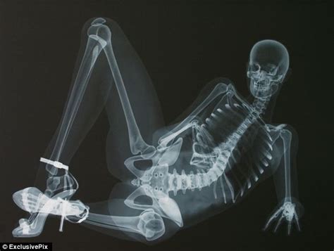 Xxx Rated Calendar Pin Up Shows Off Her Skeleton In Series Of X Ray Poses Daily Mail Online