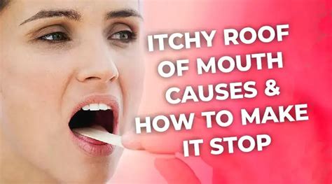 Itchy Roof Of Mouth Causes And How To Make It Stop