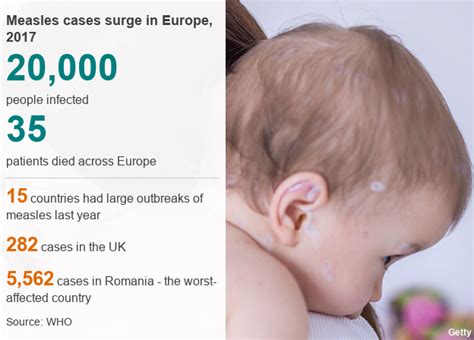 Who Warning As European Measles Rate Jumps From Record Low Bbc News