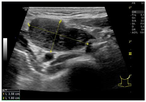 Diagnostics Free Full Text Multiparametric Ultrasound Of Cervical