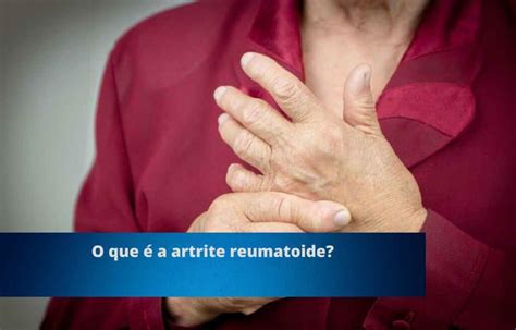 13 Coisas Para Saber Sobre Viver Artrite Reumatoide Blog