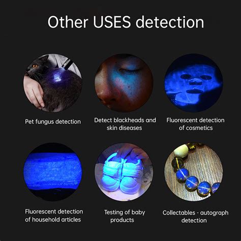 New Wood‘s Lamp Skin Fungus Detector Phosphor Vitiligo Pityriasis Vers