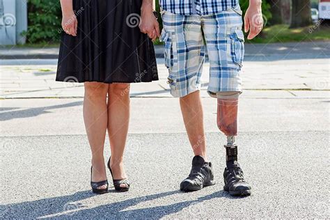 Male Amputee Wearing A Prosthetic Leg Stock Image Image Of