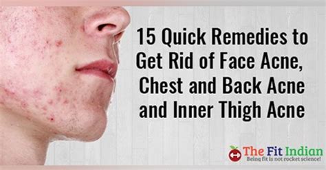 Get How To Get Rid Of Inner Thigh Blackheads Images What Is Inside A