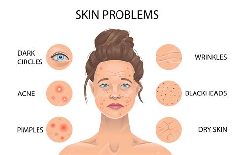 Premium Vector Skin Problems Vector Illustration