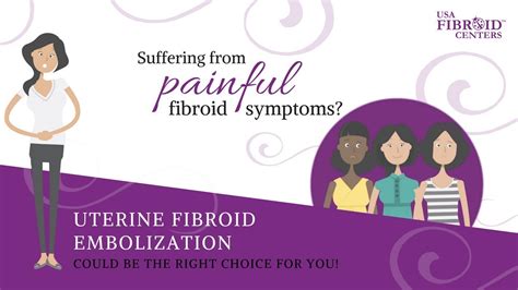 Uterine Fibroid Embolization Ufe At Usa Fibroid Centers Youtube