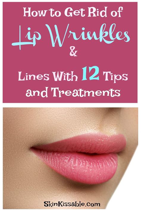 How To Get Rid Of Upper Lip Wrinkles And Lines Naturally 12 Tips Lip Wrinkles How To Line