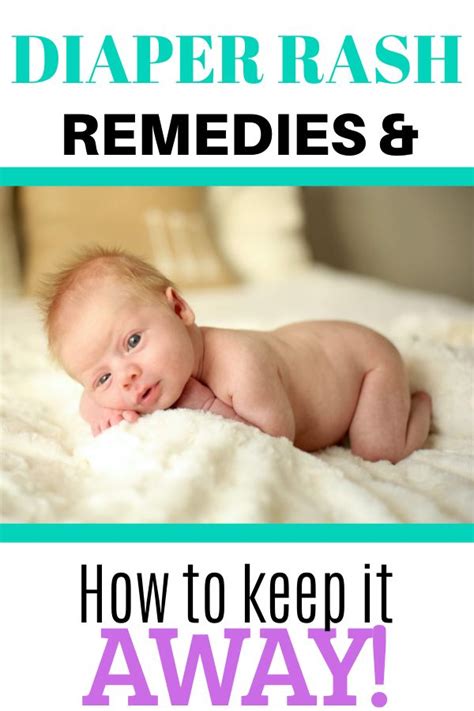 How to Get Rid of Baby's Diaper Rash Fast! - Oh Baby Love ...