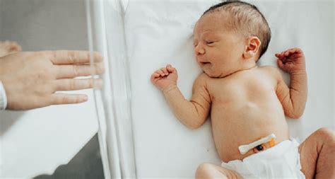 Cara Merawat Tali Pusar Bayi Agar Menjaganya Tetap Kering
