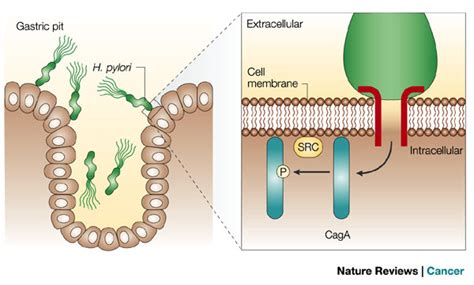 Helicobacter Pylori As A Causative Agent Of Gastric Cancer Microbewiki