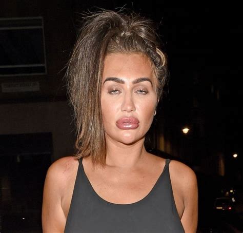 Lauren Goodger Showcases Painful Looking Plumped Up Lips And Patchy