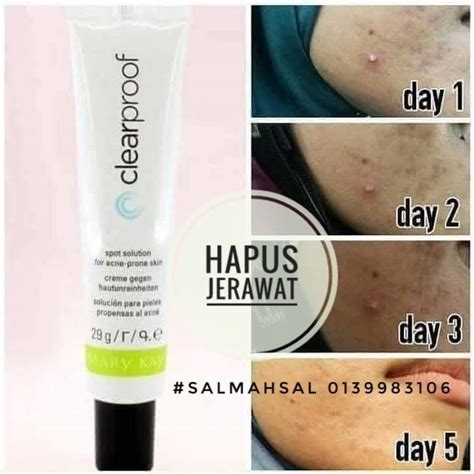 Apa punca bila garu jadi hitam. SPOT SOLUTION CLEAR PROOF ACNE SYSTEM BY MARY KAY - Cik Orkid