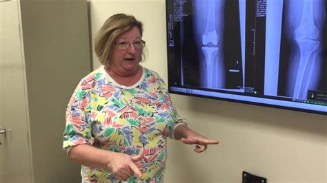 Total Knee Replacement 2 Weeks After Surgery Youtube