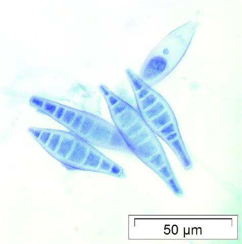 Macroconidias Fusiformes De Microsporum Canis Lactofenol Azul 400x
