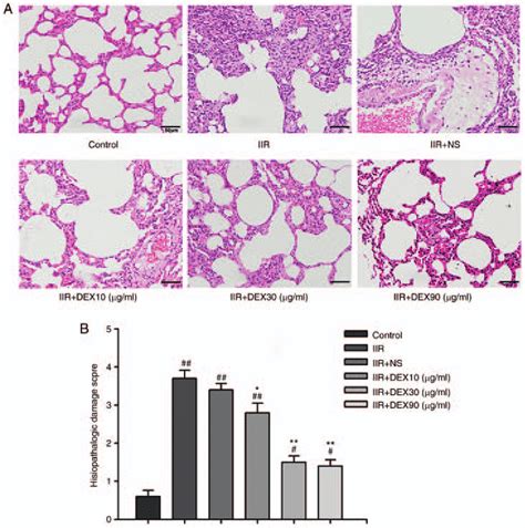 Histopathological Changes In The Lung Tissue Of Control Iir Iir Ns