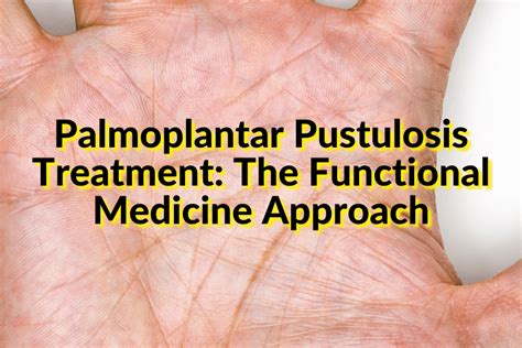 Palmoplantar Pustulosis Treatment The Functional Medicine Approach