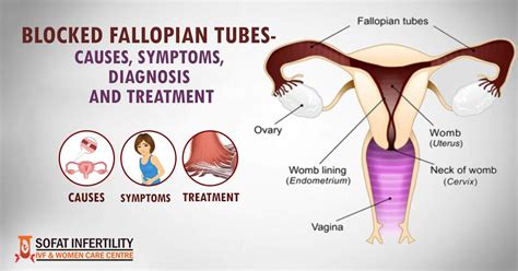 Blocked Fallopian Tubes Causes Symptoms Diagnosis And Treatment Dr