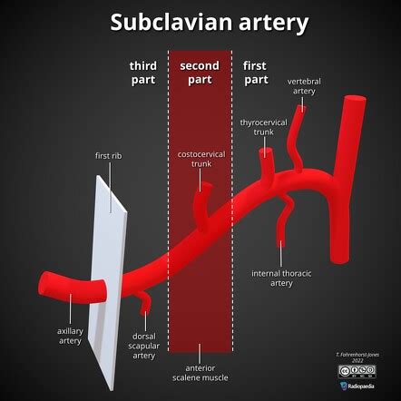 Subclavian Artery Branches Mnemonic Radiology Reference Article