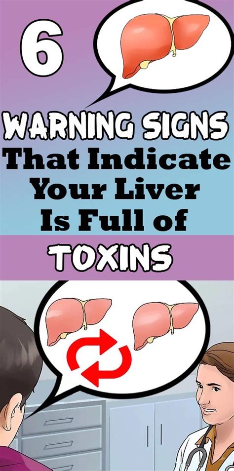 6 Warning Signs That Indicate Your Liver Is Full Of Toxins Health And