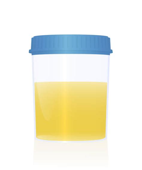 Urine Sample Cup Illustrations Royalty Free Vector Graphics And Clip Art