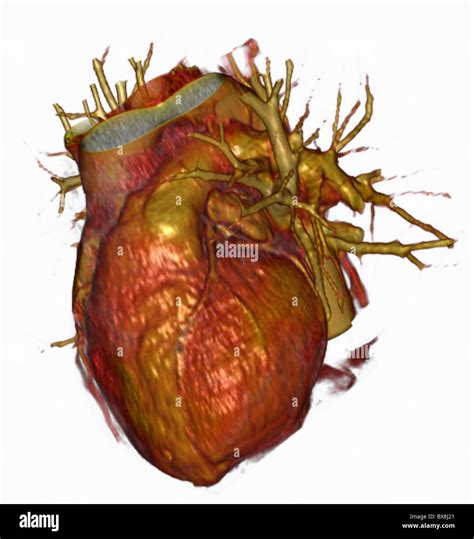 3d Ct Scan Of The Human Heart Stock Photo Alamy
