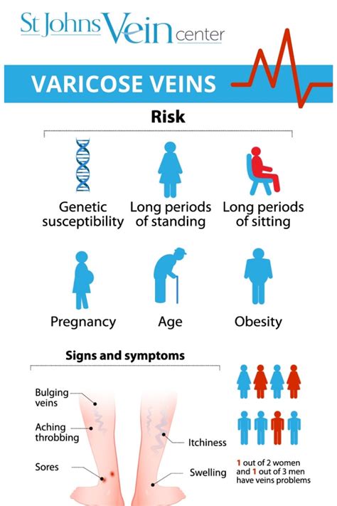 Varicose Veins 101 A Guide To Varicose Vein Symptoms And Treatment