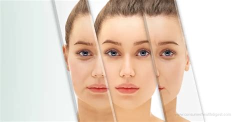 What You Should Know About Wrinkles And Fine Lines