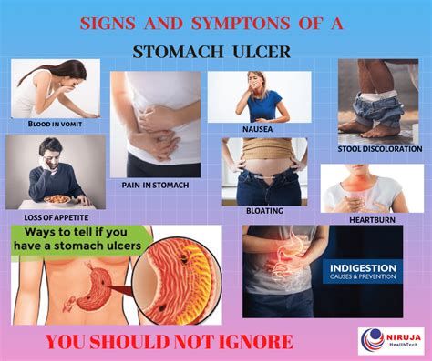 Stomach Ulcer Pain Location