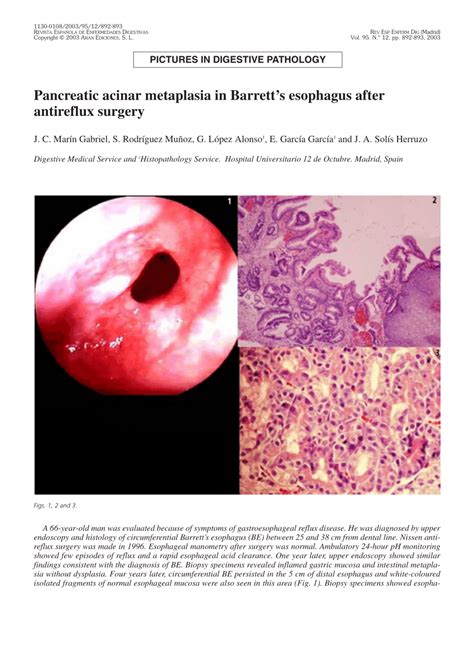 Pdf Pancreatic Acinar Metaplasia In Barretts Esophagus After
