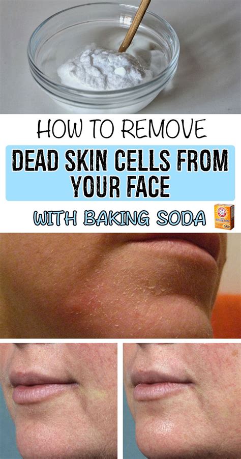 How To Remove Dead Skin Cells From Your Face With Baking Soda Dry