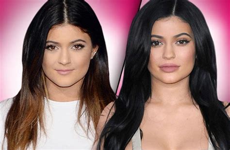 fill er up kylie jenner s new face came from a needle docs claim