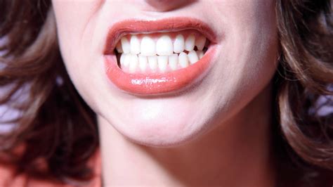 Anemia Gums And Your Oral Health My Best Dentists Journal