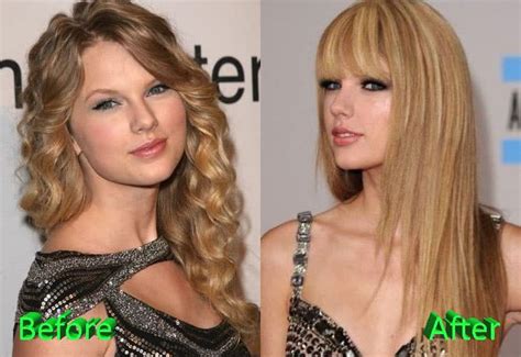 Taylor Swift Plastic Surgery Before And After Face