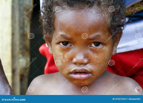 Crying Girl With Tear On Cheek Poor African Child Stock Photo Image