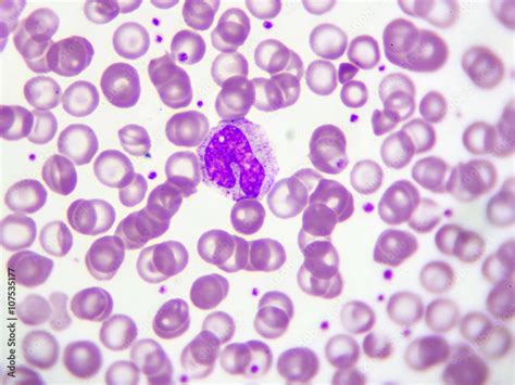 Monocyte Cell White Blood Cell In Peripheral Blood Smear Wright
