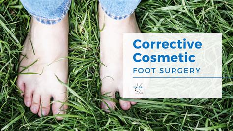 Corrective Cosmetic Foot Surgery Moore Foot And Ankle Specialists