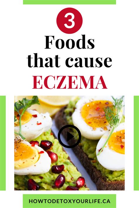 3 Eczema Trigger Foods Healthy Eating Habits Eczema Foods To Avoid