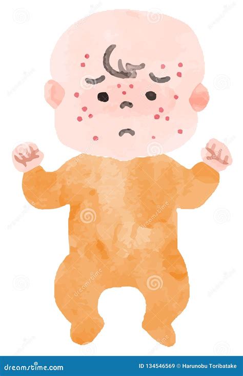 Baby Rash Skin Rash Cartoon Vector 67052067