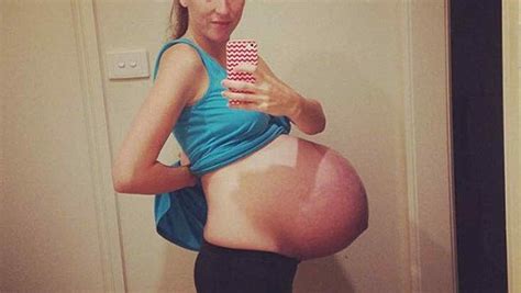 Embarazo en la adolescencia 120. Grupos están robando fotos de mujeres embarazadas de ...