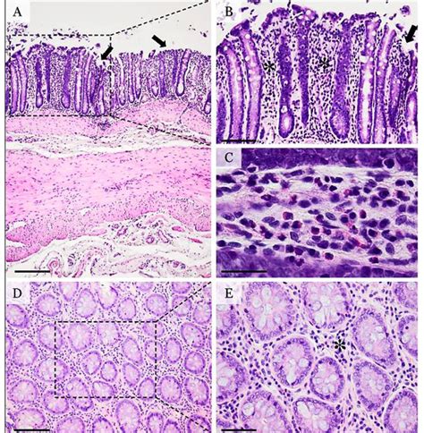 Histopathological Micrographs Of Dss Induced Colitis A General View Of
