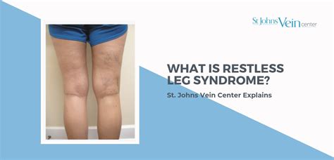 What Is Restless Leg Syndrome Sjvc Explains
